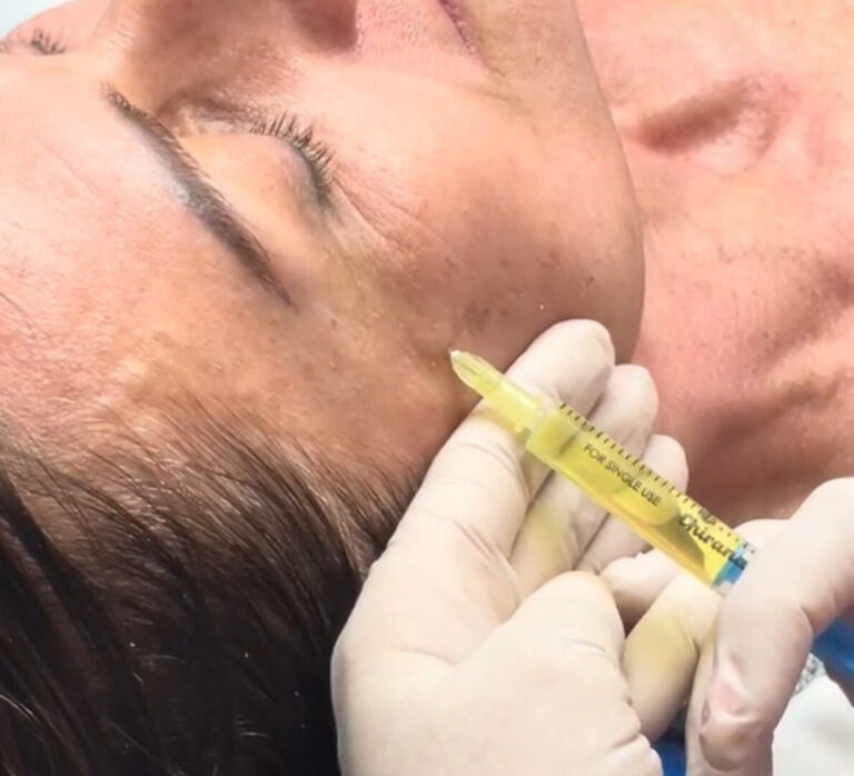 skinbooster