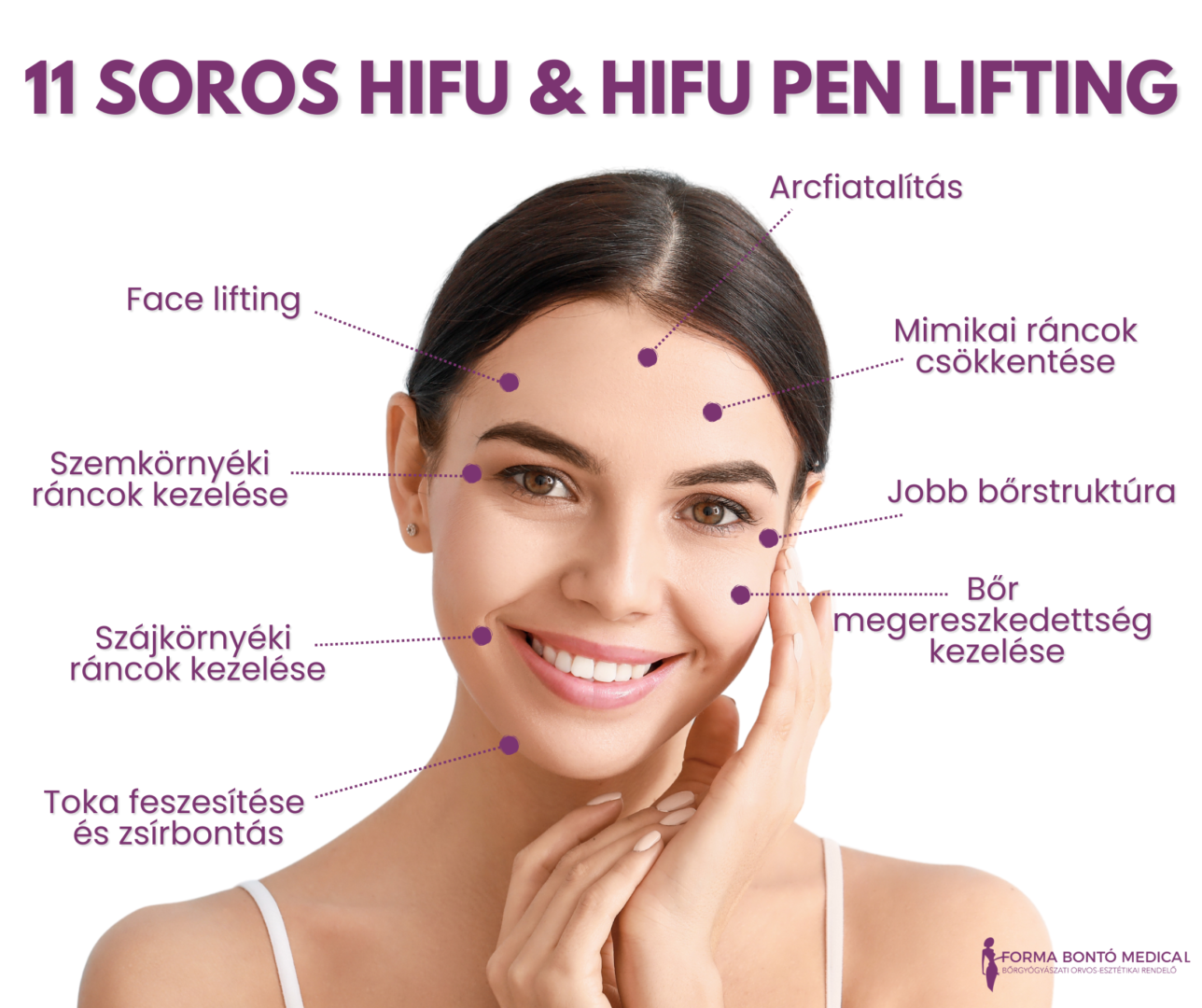 hifu kezelés előnyei